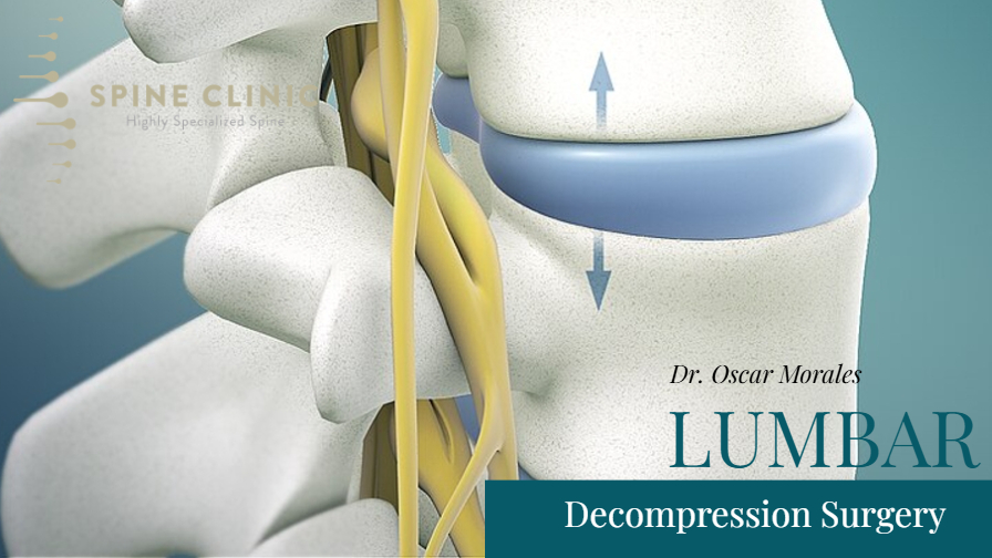 Lumbar Decompression Surgery – Puerto Vallarta – Riviera Nayarit