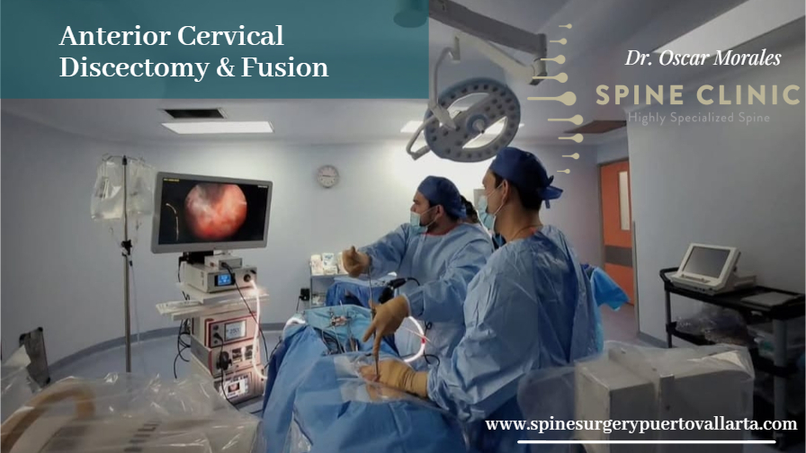 Cervical Spine Surgery Puerto Vallarta Riviera Nayarit Mexico